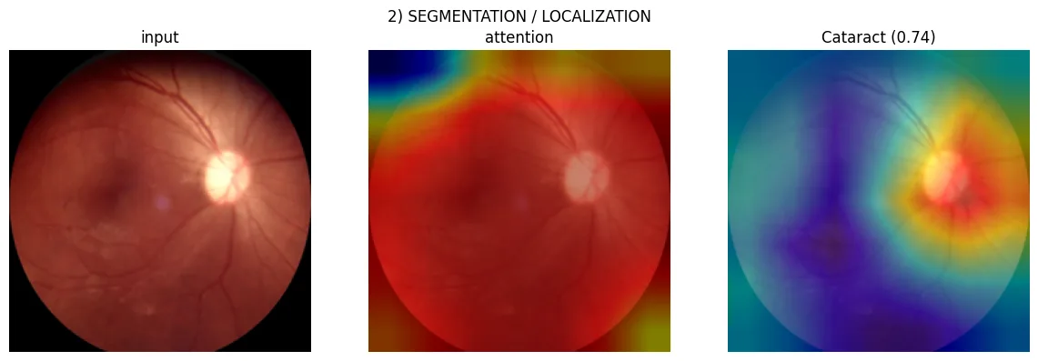 Fundus image, attention map and per-disease localisation